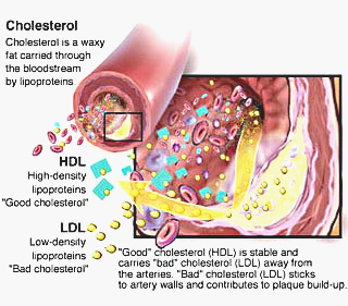 sekilas tentang kolesterol HDL dan LDL
